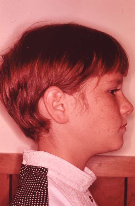 freckles, profile, Portraits - Individual, Children, Iowa, Zischke, Ward, Iowa History, haircut, IA, history of Iowa